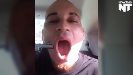 Rapper Shoots Self In Face For His Upcoming Music Video