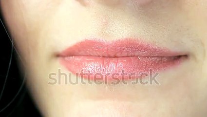 Veneers Hollywood smile in Dubai - hellenicdentalclinic.com