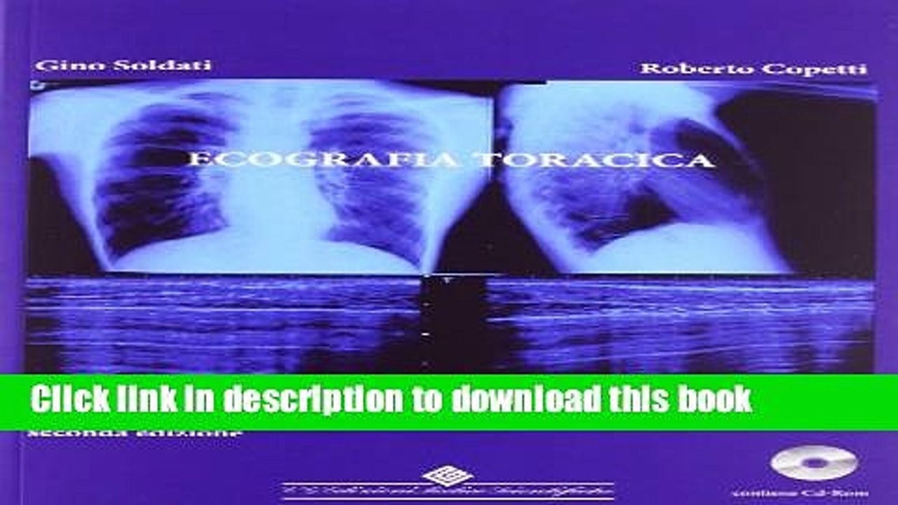 Read Ecografia toracica. Con CD-ROM Ebook Free