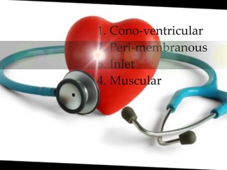 Ventricular Septal Defect - VSD - Diagnosis & Treatment