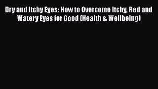 Read Dry and Itchy Eyes: How to Overcome Itchy Red and Watery Eyes for Good (Health & Wellbeing)