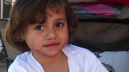 Farah: Scarred by Gaza's War - Al Jazeera World