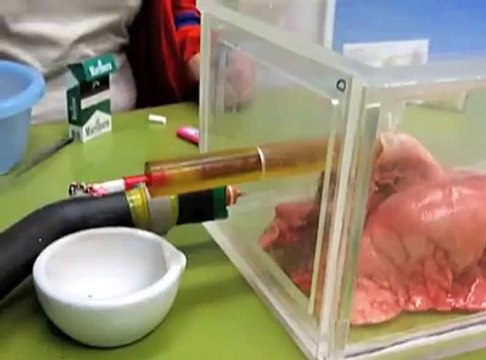 Voilà à quoi vos poumons ressemblent après 20 cigarettes