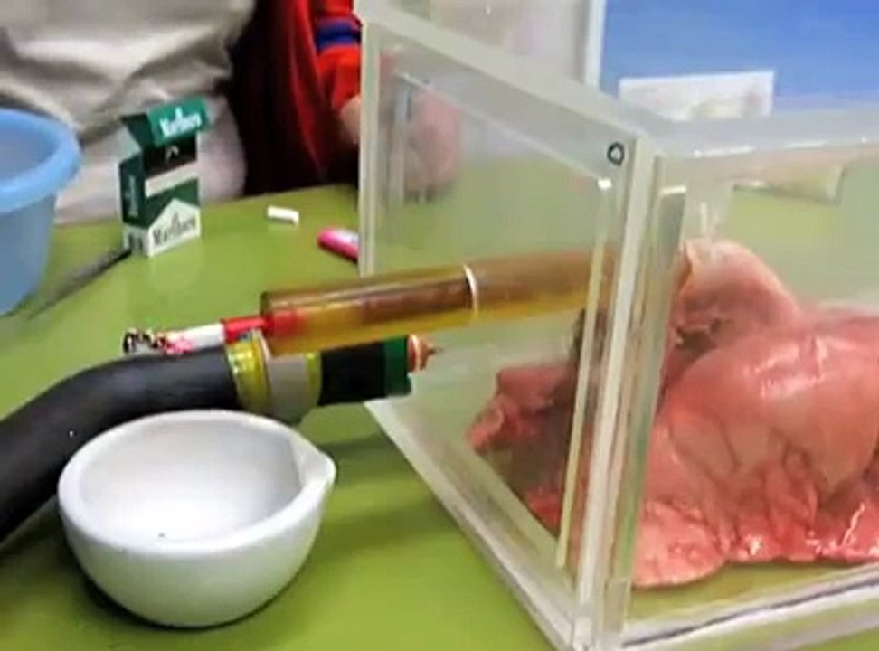 Voilà à quoi vos poumons ressemblent après 20 cigarettes