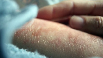 One Woman's Inspiring Skin Story | Embrace Your Skin - Racinne