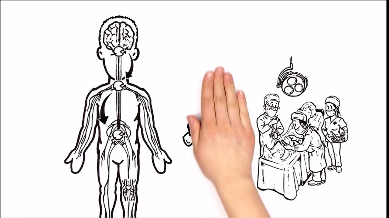riabilitazione ginocchio dopo artroscopia