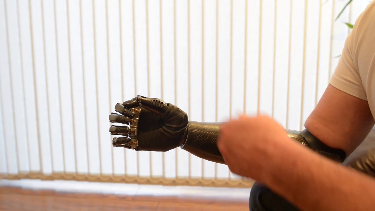 Cet homme a une prothèse contrôlée par ses mouvements !
