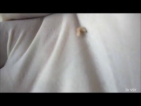 He Went In Complaining About Ear Pain… What The Doctor Discovers Shocked Them Both