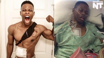 An Artificial Heart Won't Stop This Bodybuilder From Pursuing His Dream