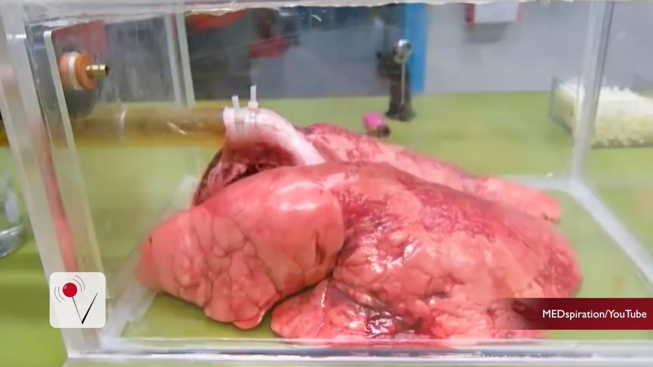 This is What Your Lungs Look Like After 20 Cigarettes