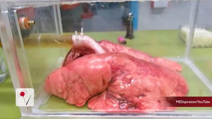 This is What Your Lungs Look Like After 20 Cigarettes