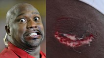 Warren Sapp Attacked By Shark