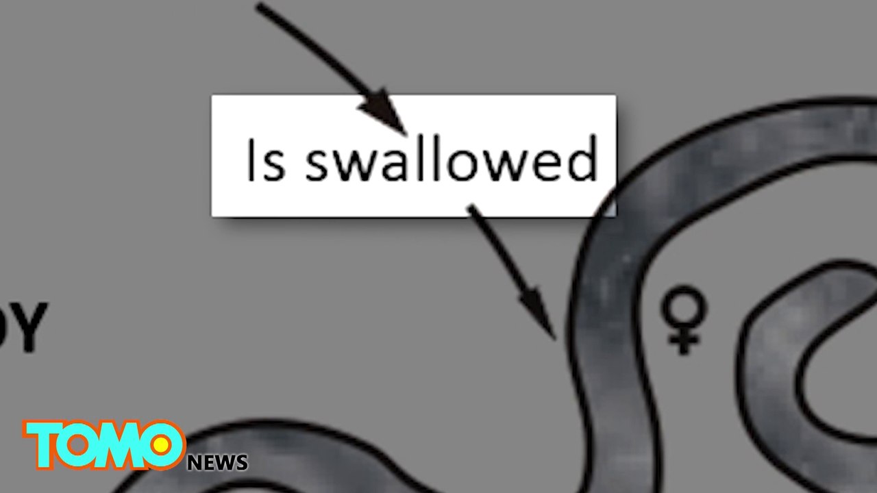 Worms in human body: video shows doctors removing two long ascaris worms from liver - TomoNews