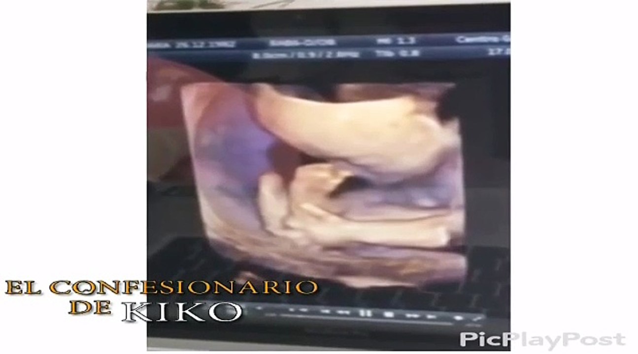 Juanma, de 'GH 15', comparte la última ecografía de Azahara, de 23 semanas