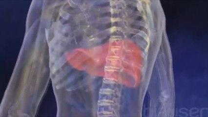 الصحة العالمية تحذر من خطر التهاب الكبد الفيروسي