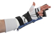 Riabilitazione e fisioterapia lesione dei tendini flessori della mano
