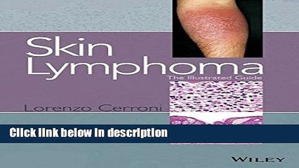 Books Skin Lymphoma: The Illustrated Guide Free Online