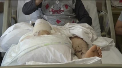 Darbecilere Direnen İmam, Bacağını Kaybetti