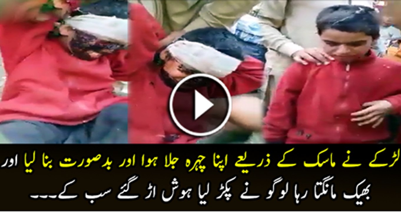 Larke Ne Mask K Zarye Se Apna Chara Jalaya Howa Or Bedsoorat Banaya howa Tha