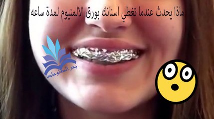 ماذا يحدث عندما تغطي اسنانك بورق الالمنيوم لمدة ساعه