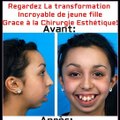 INCROYABLE CHANGEMENT D’UNE JEUNE FILLE GRACE À LA CHIRURGIE ESTHÉTIQUE