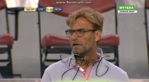 Stewart Horror Injury  - Liverpool vs AC Milan 0-0   31/7/2016