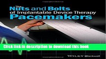 Ebook The Nuts and Bolts of Implantable Device Therapy: Pacemakers (The Nuts and Bolts Series)