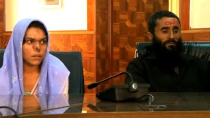 Kocası Tarafından Burnu Koparıldıktan Sonra Türkiye'de Tedavi Gören Reza Gül'den Türkiye'ye Teşekkür