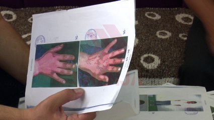 Vrasja në Gjorçe, familjarët: Vendimi gjyqësor ishte politik