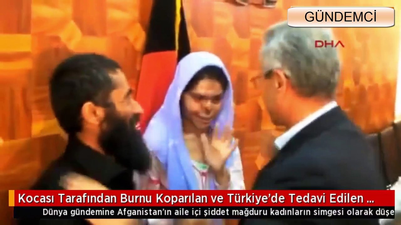 Kocası Tarafından Burnu Koparılan Kadın
