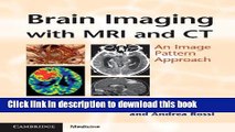 Ebook|Books} Brain Imaging with MRI and CT: An Image Pattern Approach Full Online