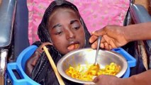 Girl-Born-With-No-Hands-or-Legs-Lives-Inside-A-Bowl