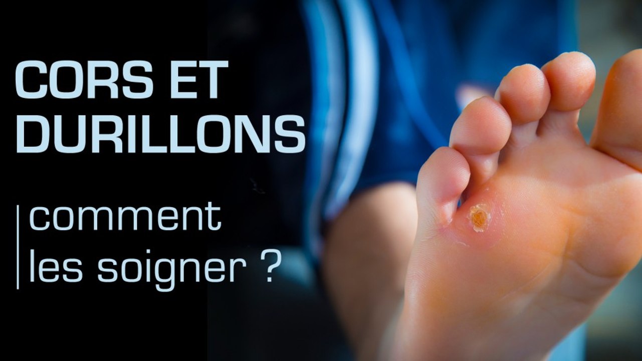 Comment Enlever Un Durillon Sous Le Pied Video