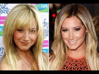 12 Celebrities Before and After Surgery