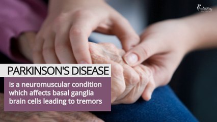 Symptoms and Causes of Parkinson's Disease