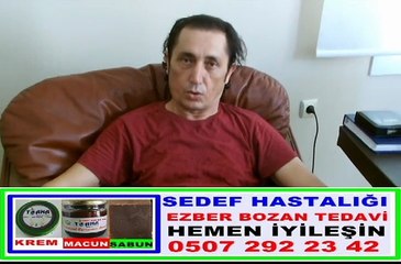 SEDEF HASTALIĞI
