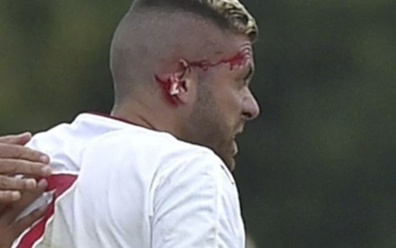 Jérémy Menez perd un bout d'oreille - Bordeaux vs. Lorient