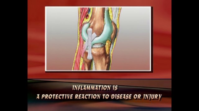 Yoga Exercises for Arthritis - Knee Pain, Backpain Treatment & Diet Tips in English