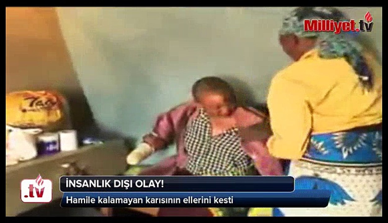 Hamile kalamayan karısının ellerini kesti