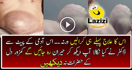 Very Bad Situation If You are Not Focusing on it