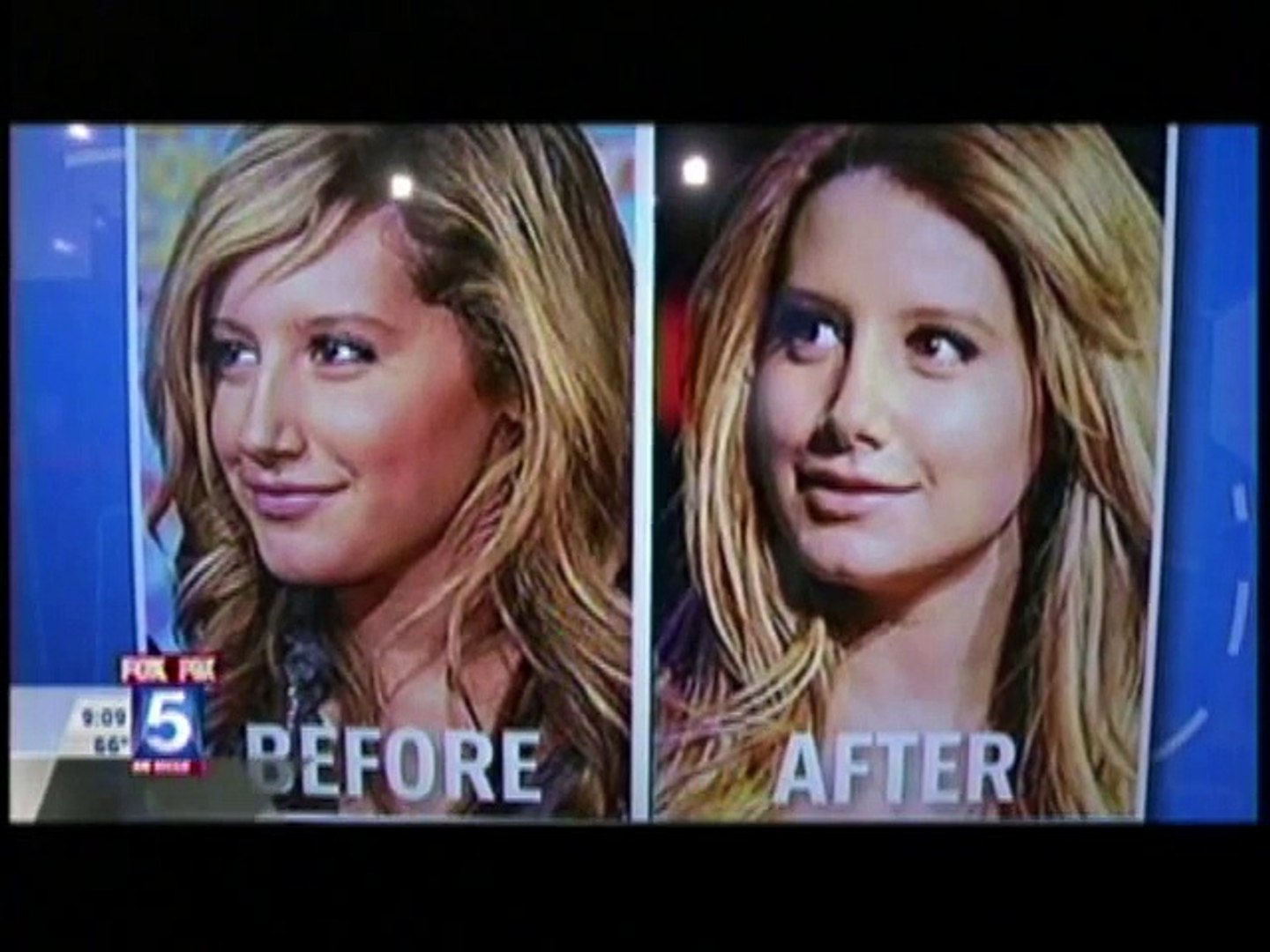 Do Selfies make you want Plastic Surgery