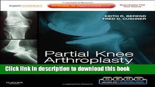 Books Partial Knee Arthroplasty: Techniques for Optimal Outcomes with DVD; Expert Consult -