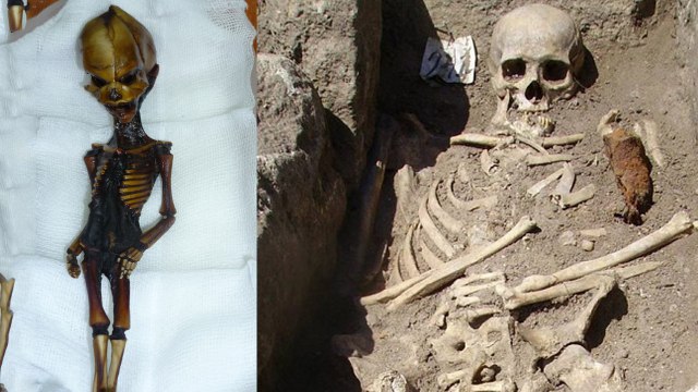 Top 10 Bizarre Skeletons Ever Found