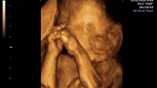 My 24 Week 3D Ultra Sound Video