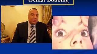 Eye Movements Disorders  ( Ocular Bobbing ) 28/34