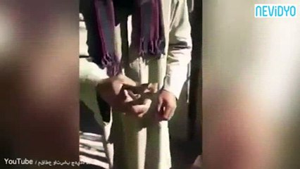 Bu görüntüler, dişçiye gitmeye tövbe ettirecek!