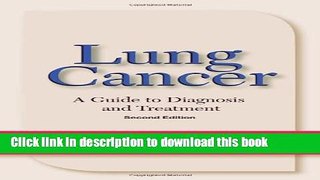 Ebook Lung Cancer: A Guide to Diagnosis and Treatment Free Online