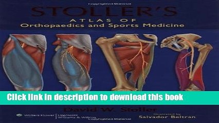 Download Stoller s Atlas of Orthopaedics and Sports Medicine Book Online