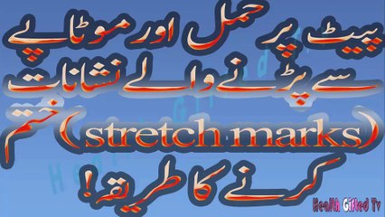 After Pregnancy Ur Motape Say Pait par parne Wale Nishanat ko khatam karnay ka tarika..