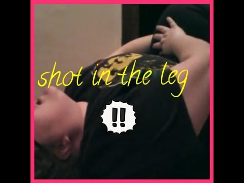 Got shot  in the leg